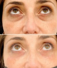 𝑴𝑬𝑵 𝑬𝑿𝑷𝑬𝑹𝑻 - 𝑹𝑶𝑳𝑳𝑬𝑹 𝑨𝑵𝑻𝑰 𝑶𝑱𝑬𝑹𝑨𝑺