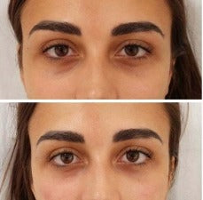 𝑴𝑬𝑵 𝑬𝑿𝑷𝑬𝑹𝑻 - 𝑹𝑶𝑳𝑳𝑬𝑹 𝑨𝑵𝑻𝑰 𝑶𝑱𝑬𝑹𝑨𝑺